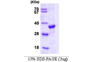 SDS-PAGE (SDS) image for STIP1 Homology and U-Box Containing Protein 1 (STUB1) (AA 1-303) protein (ABIN666729)