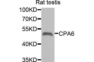 Western blot analysis of extracts of rat testis, using CPA6 antibody (ABIN5975028) at 1/1000 dilution. (CPA6 anticorps)