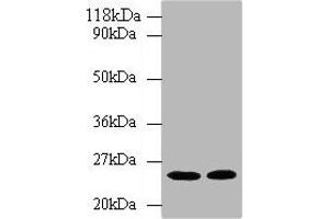Western blot All lanes: HMGCR antibody at 2 μg/mL Lane 1: Hela whole cell lysate Lane 2: 293T whole cell lysate Secondary Goat polyclonal to rabbit IgG at 1/10000 dilution Predicted band size: 98, 93, 100 kDa Observed band size: 25 kDa
