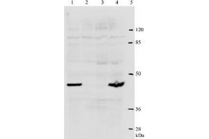 Western Blotting (WB) image for anti-Human Papilloma Virus Type 18 (HPV-18) (AA 1-83), (N-Term) antibody (ABIN781773) (HPV18 anticorps  (N-Term))