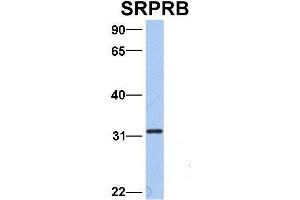 Host:  Rabbit  Target Name:  SRPRB  Sample Type:  Hela  Antibody Dilution:  1. (SRPRB anticorps  (Middle Region))