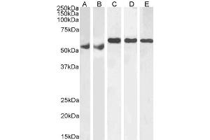 ABIN185160 (1µg/ml) staining of Human Testes (A), Human Ovary (B), Mouse Testes (C), Rat Testes (D) and Rat Ovary (E) lysate (RIPA buffer, 35µg total protein per lane).