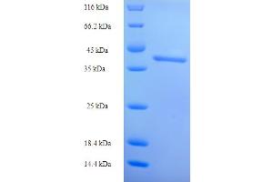 SDS-PAGE (SDS) image for Intestine-Specific Homeobox (ISX) (AA 1-245), (full length) protein (His tag) (ABIN5709769)