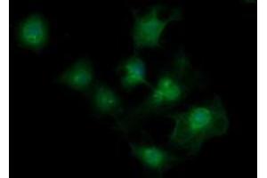 Image no. 3 for anti-Melanoma Antigen Family A, 4 (MAGEA4) antibody (ABIN1499260)
