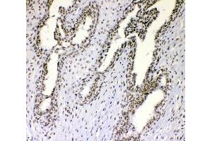 IHC analysis of nmt55/p54nrb using anti-nmt55/p54nrb antibody (ABIN3044530).
