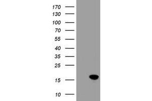 Image no. 2 for anti-Cellular Retinoic Acid Binding Protein 2 (CRABP2) antibody (ABIN1497620) (CRABP2 anticorps)