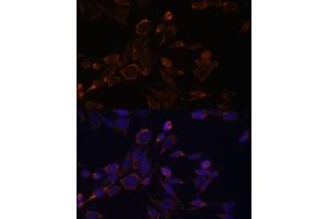Immunofluorescence analysis of NIH-3T3 cells using  antibody (ABIN6131164, ABIN6136413, ABIN6136415 and ABIN6217209) at dilution of 1:100.