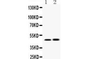 Western blot analysis of IKK gamma using anti-IKK gamma antibody .