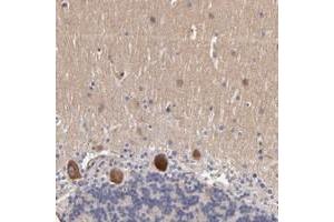 Immunohistochemical staining of human cerebellum with DACT1 polyclonal antibody  shows strong cytoplasmic positivity in purkinje cells. (DACT1 anticorps)