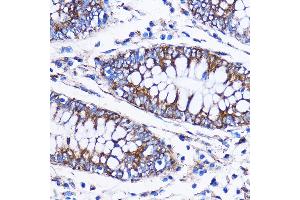 Immunohistochemistry of paraffin-embedded Human colon using IC Rabbit pAb (7500) at dilution of 1:100 (40x lens). (ICA1 anticorps  (AA 1-160))