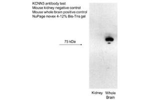 KCNN3 antibody - C-terminal region  validated by WB using Mouse kidney, Whole brain lysate at 2 ug/ml. (KCNN3 anticorps  (C-Term))
