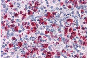 Human Spleen: Formalin-Fixed, Paraffin-Embedded (FFPE) (ARHGAP18 anticorps  (C-Term))