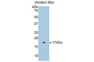 Western blot analysis of the recombinant protein. (IL-2 anticorps  (AA 21-153))