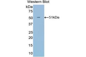 Western blot analysis of the recombinant protein. (IFNA21 anticorps  (AA 25-189))