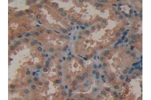 Figure. (MMP12 anticorps  (AA 290-469))