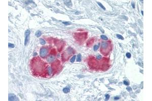 Immunohistochemistry (IHC) image for anti-Phenylalanyl-tRNA Synthetase, beta Subunit (FARSB) (AA 234-342) antibody (ABIN614697)