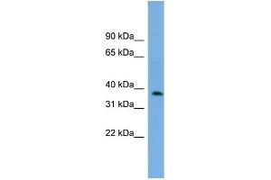 WB Suggested Anti-C17orf48 Antibody Titration: 0. (ADPRM anticorps  (Middle Region))