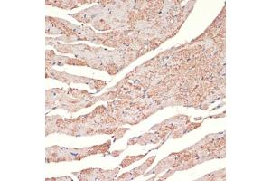 Immunohistochemistry of paraffin-embedded mouse heart using A antibody (ABIN1678588, ABIN3015506, ABIN3015508 and ABIN6218562) at dilution of 1:100 (40x lens). (alpha 1 Adrenergic Receptor anticorps  (AA 346-475))