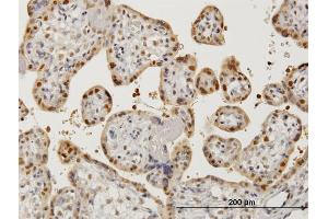 Immunoperoxidase of monoclonal antibody to AATF on formalin-fixed paraffin-embedded human placenta. (AATF anticorps  (AA 151-250))