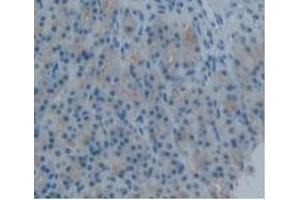 Detection of PAI2 in Rat Stomach Tissue using Monoclonal Antibody to Plasminogen Activator Inhibitor 2 (PAI2)