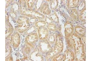 Immunohistochemical of paraffin-embedded human kidney tissue using ABIN7148973 at dilution of 1:200 (CST3 anticorps)