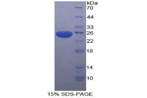 SDS-PAGE analysis of Rat SDF4 Protein. (SDF4 Protéine)
