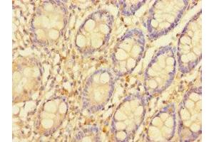 Immunohistochemistry of paraffin-embedded human colon tissue using ABIN7169844 at dilution of 1:100 (SGTB anticorps  (AA 14-304))