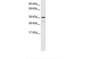 Image no. 1 for anti-Vacuolar Protein Sorting 72 Homolog (S. Cerevisiae) (VPS72) (AA 179-228) antibody (ABIN6735920) (VPS72 anticorps  (AA 179-228))