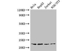 Western Blot Positive WB detected in: Hela whole cell lysate, HepG2 whole cell lysate, Jurkat whole cell lysate, NIH/3T3 whole cell lysate All lanes: RPS5 antibody at 3. (RPS5 anticorps  (AA 1-204))