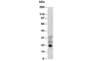 Western blot testing of FGF4 antibody and HeLa cell lysate (FGF4 anticorps)