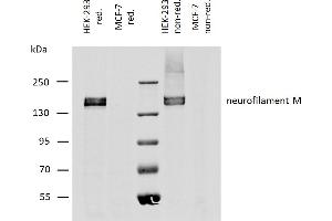 Western blotting analysis of human neurofilament M protein using mouse monoclonal antibody NF-09 on lysates of HEK-293 cell line, and MCF-7 cell line (neurofilament non-expressing cell line, negative control) under reducing and non-reducing conditions. (NEFM anticorps)