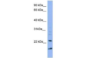 WB Suggested Anti-IMP3 Antibody Titration: 0. (IMP3 anticorps  (Middle Region))