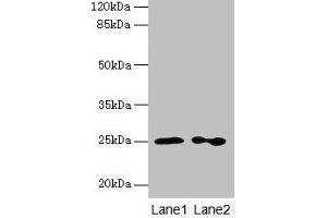 Western blot All lanes: RAB11B antibody at 2 μg/mL Lane 1: Hela whole cell lysate Lane 2: Rat gonadal tissue Secondary Goat polyclonal to rabbit IgG at 1/10000 dilution Predicted band size: 25, 20 kDa Observed band size: 25 kDa (RAB11B anticorps  (AA 2-215))