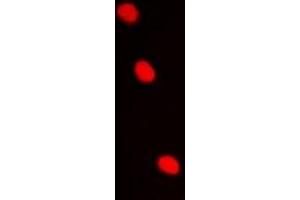 Immunofluorescent analysis of AES staining in Hela cells.
