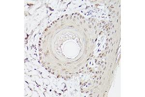 Immunohistochemistry of paraffin-embedded Rat skin using Pea3 / ETV4 antibody (ABIN6131217, ABIN6140332, ABIN6140334 and ABIN6221480) at dilution of 1:100 (40x lens).