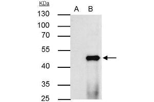 IP Image PPAR alpha antibody immunoprecipitates PPAR alpha protein in IP experiments. (PPARA anticorps  (N-Term))