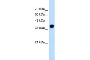 Western Blotting (WB) image for anti-Squalene Epoxidase (SQLE) antibody (ABIN2462528)