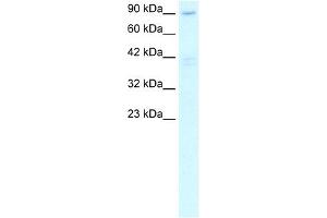 WB Suggested Anti-C20ORF194 Antibody Titration: 2. (C20orf194 anticorps  (C-Term))