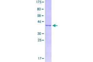 Image no. 1 for Stearoyl-CoA Desaturase (Delta-9-Desaturase) (SCD) (AA 1-100) protein (GST tag) (ABIN2565209)
