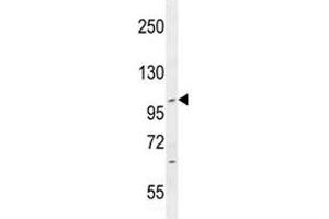 IFT88 antibody western blot analysis in CEM lysate. (IFT88 anticorps  (AA 791-820))