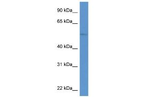WB Suggested Anti-ZIC3 Antibody Titration:  0. (ZIC3 anticorps  (N-Term))