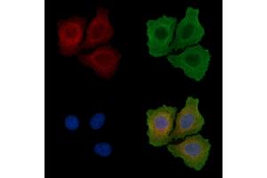 ABIN6255918 and ABIN6267675 staining Hela cells(serum starvation) by IF/ICC. (FRS2 anticorps  (pTyr436))