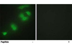 Immunofluorescence analysis of HepG2 cells, using CREBZF polyclonal antibody . (CREBZF anticorps)