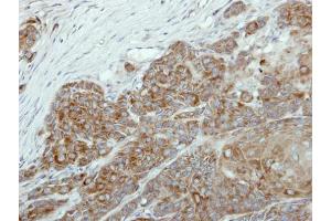 IHC-P Image Immunohistochemical analysis of paraffin-embedded Cal27 xenograft, using NR0B1, antibody at 1:100 dilution. (NR0B1 anticorps)
