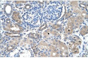 Rabbit Anti-SARDH Antibody  Paraffin Embedded Tissue: Human Kidney Cellular Data: Epithelial cells of renal tubule Antibody Concentration: 4. (SARDH anticorps  (Middle Region))