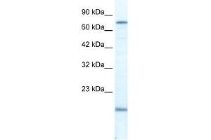 PGBD3 antibody used at 2. (PGBD3 anticorps  (N-Term))
