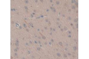 IHC-P analysis of Rat Tissue, with DAB staining. (TGM1 anticorps  (AA 504-737))
