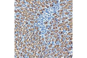 IHC analysis of RAB7/RAB7A using anti-RAB7/RAB7A antibody (ABIN7600597). (RAB7A anticorps  (AA 21-177))