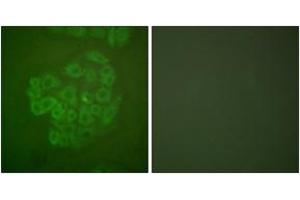 Immunofluorescence analysis of A549 cells, using GR (Ab-211) Antibody. (GR (AA 181-230) anticorps)