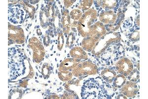 ApoBEC3D antibody was used for immunohistochemistry at a concentration of 12. (APOBEC3D anticorps)